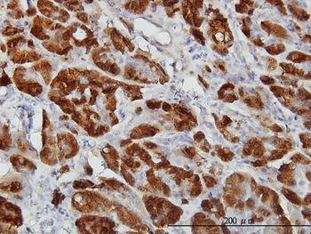 CTH monoclonal antibody (M03), clone S51