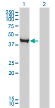 CTH monoclonal antibody (M03), clone S51