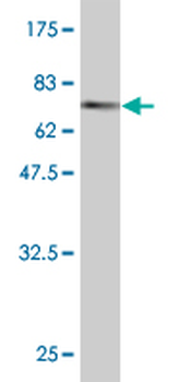 CTH monoclonal antibody (M03), clone S51
