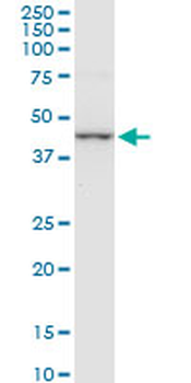CTH monoclonal antibody (M01A), clone 4E1-1B7