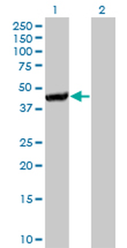 CTH monoclonal antibody (M01A), clone 4E1-1B7