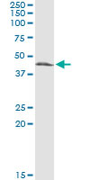 CTH monoclonal antibody (M01), clone 4E1-1B7