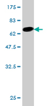 CTH monoclonal antibody (M01), clone 4E1-1B7