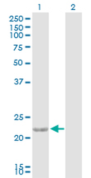 CTF1 purified MaxPab rabbit polyclonal antibody (D01P)