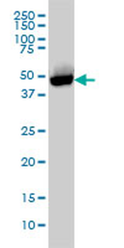 CTBP1 monoclonal antibody (M01), clone 2G7