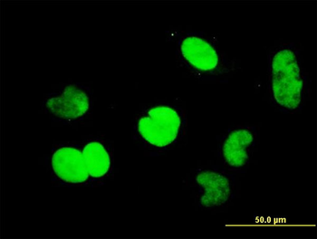 CTBP1 monoclonal antibody (M01), clone 2G7