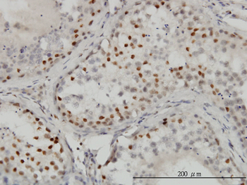 CTBP1 monoclonal antibody (M01), clone 2G7