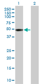 CTBS purified MaxPab rabbit polyclonal antibody (D01P)