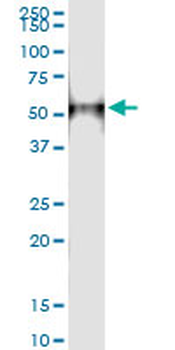 CTBS MaxPab rabbit polyclonal antibody (D01)
