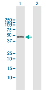 CTBS MaxPab rabbit polyclonal antibody (D01)