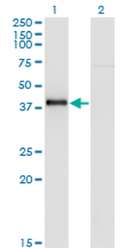 NKX2-5 monoclonal antibody (M05), clone 4B11