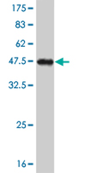 NKX2-5 monoclonal antibody (M05), clone 4B11