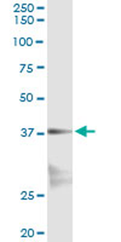 NKX2-5 monoclonal antibody (M04), clone 3C1