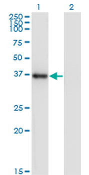 NKX2-5 monoclonal antibody (M04), clone 3C1