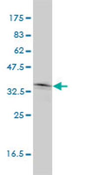 NKX2-5 monoclonal antibody (M01), clone 1E4-G5