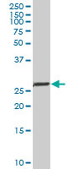 NKX2-5 monoclonal antibody (M01), clone 1E4-G5