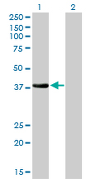 NKX2-5 monoclonal antibody (M01), clone 1E4-G5