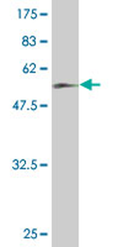 NKX2-5 monoclonal antibody (M01), clone 1E4-G5