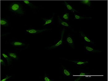 CSTF2 monoclonal antibody (M02), clone 4E3-3C9