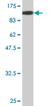 CSTF2 monoclonal antibody (M02), clone 4E3-3C9