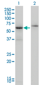 CSTF2 monoclonal antibody (M01), clone 3D1-3A6