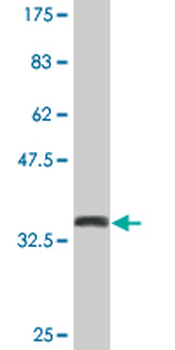 CSTF1 monoclonal antibody (M01), clone 1C6