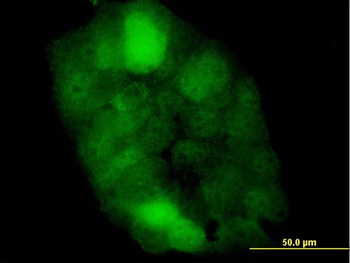 CSTB monoclonal antibody (M02), clone M2-F1