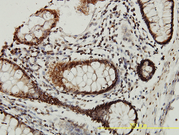 CSTB monoclonal antibody (M02), clone M2-F1
