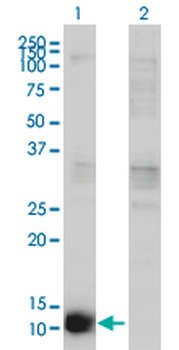 CSTB monoclonal antibody (M02), clone M2-F1