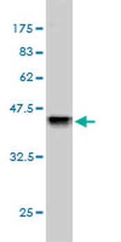 CSTB monoclonal antibody (M02), clone M2-F1