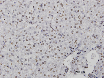 CSTB monoclonal antibody (M01), clone M1-C1