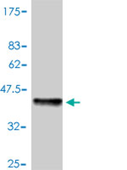 CSTB monoclonal antibody (M01), clone M1-C1