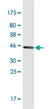 CST2 monoclonal antibody (M04), clone 4E10