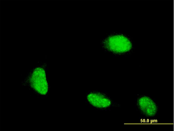 CSRP1 monoclonal antibody (M06), clone 2A11