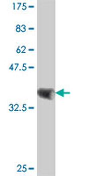 CSRP1 polyclonal antibody (A01)