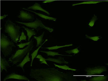 CSNK2A2 monoclonal antibody (M03), clone 1E8