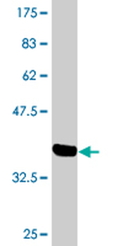 CSNK2A2 monoclonal antibody (M03), clone 1E8