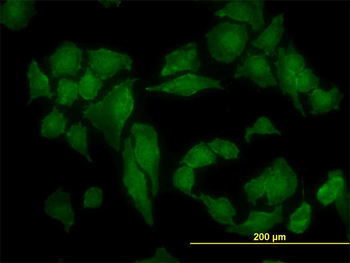 CSNK2A1 monoclonal antibody (M01), clone 3D9