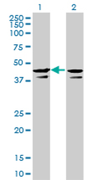 CSNK2A1 monoclonal antibody (M01), clone 3D9