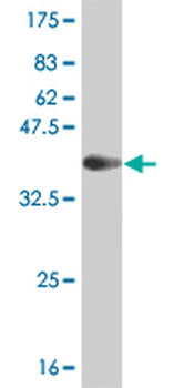 CSNK2A1 monoclonal antibody (M01), clone 3D9