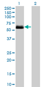 CSNK1G2 monoclonal antibody (M08), clone 2F5