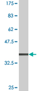 CSNK1G2 monoclonal antibody (M08), clone 2F5