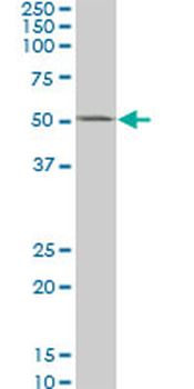 CSNK1G2 monoclonal antibody (M02), clone 2E6