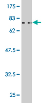 CSNK1G2 monoclonal antibody (M02), clone 2E6