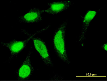 CSNK1D monoclonal antibody (M09), clone 4H8