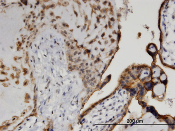 CSNK1D monoclonal antibody (M09), clone 4H8
