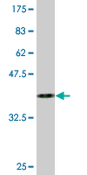 CSNK1D monoclonal antibody (M09), clone 4H8