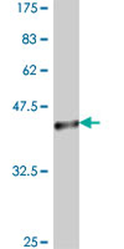 CSNK1D polyclonal antibody (A01)