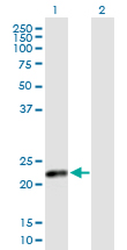 CSH2 purified MaxPab mouse polyclonal antibody (B02P)