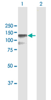 CSF3R MaxPab rabbit polyclonal antibody (D01)